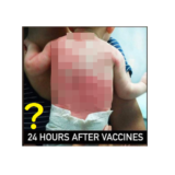 「ワクチン接種２４時間後の幼児の画像」はデマ